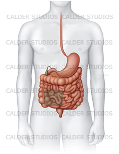 Crohn's illustration